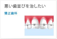 悪い歯並びを治したい矯正歯科